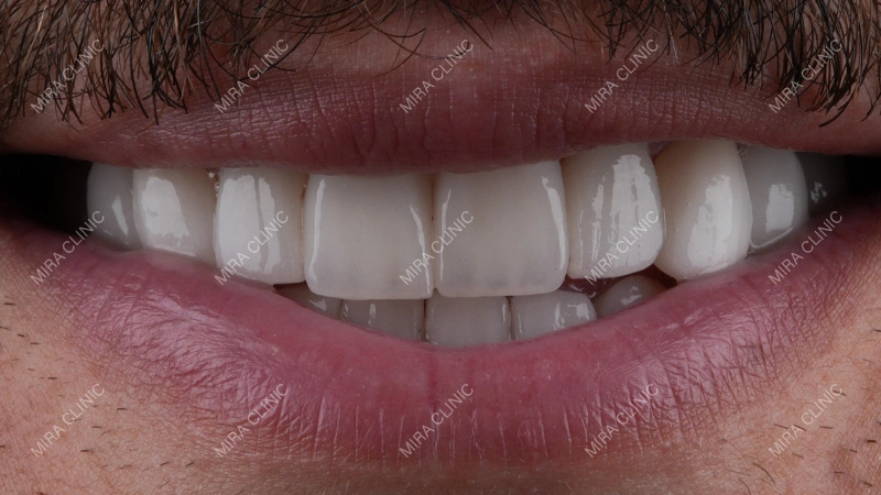 Designing a Smile